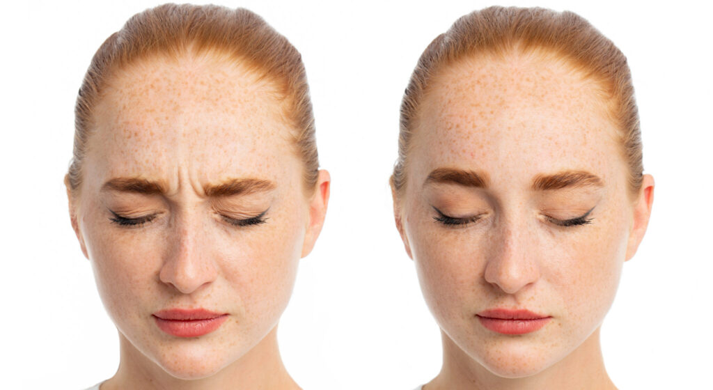 botox-shutterstock_1799301898-1-scaled