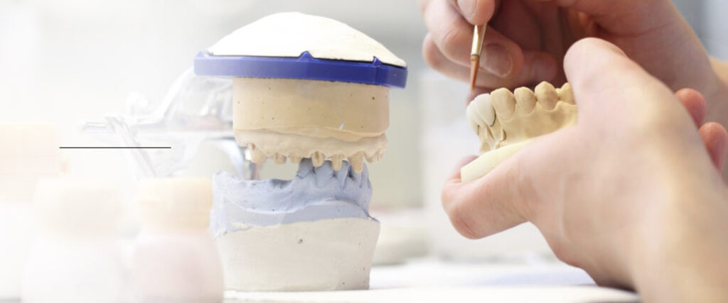 porcelain-veneer_slider-1-1030x429