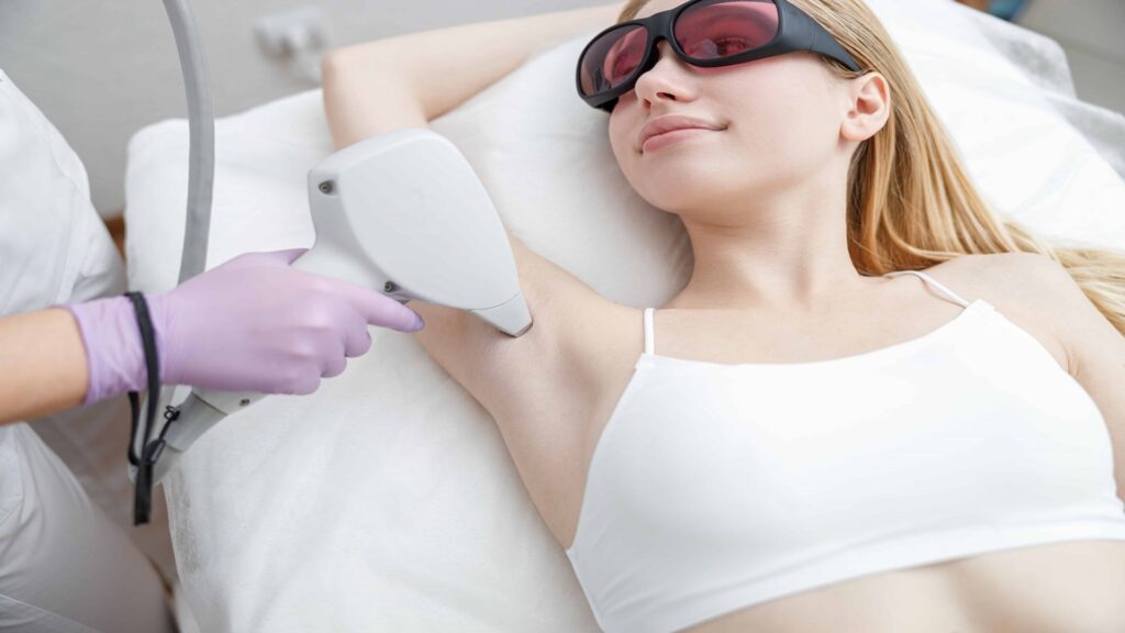 laser treatment for pigmentation