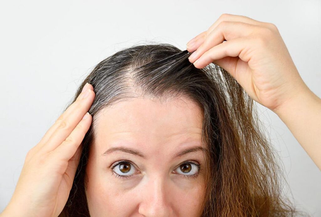 woman-with-hair-loss