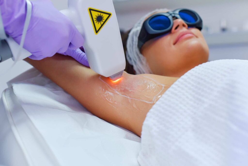 Laser-Hair-Removal-1-scaled-1 (1)