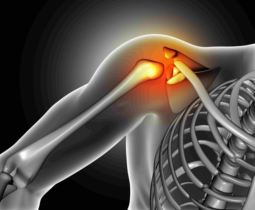 Shoulder Surgery_11zon