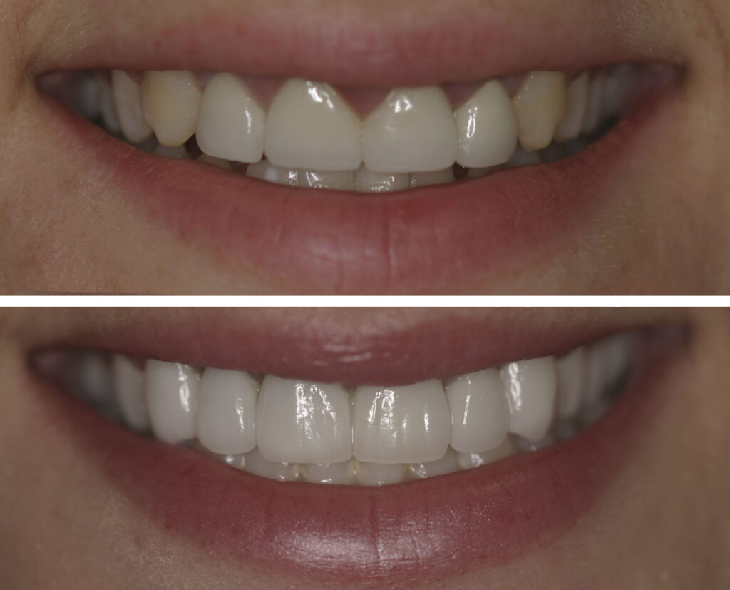 cosmetic dentistry nyc
