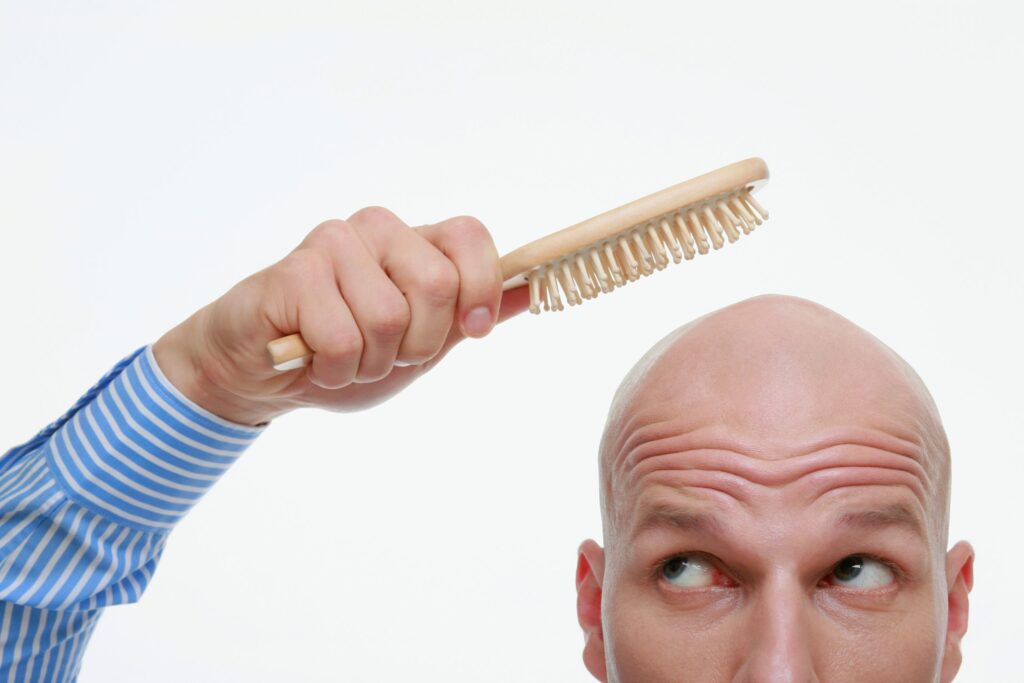 male balding cure