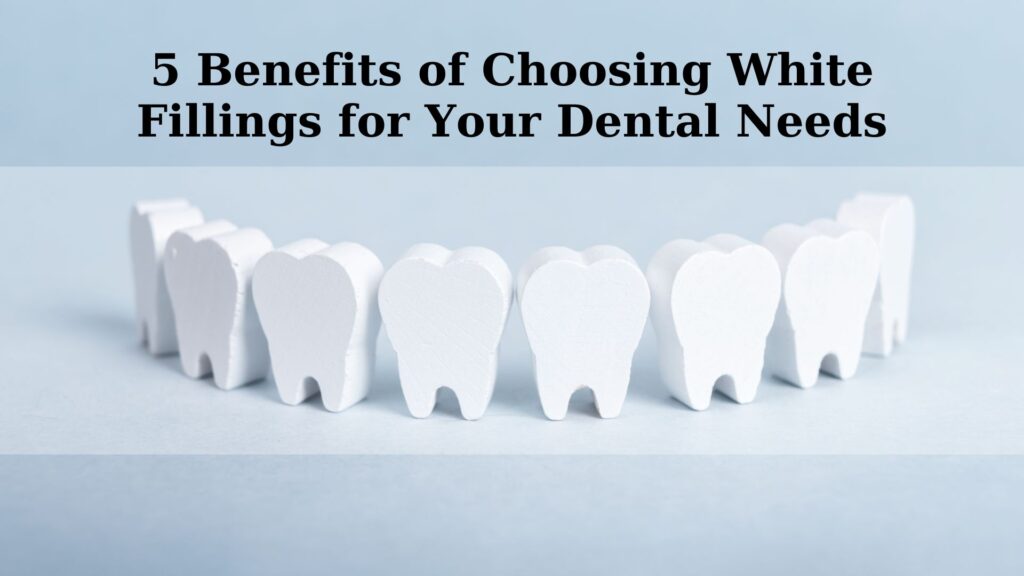 5 Benefits of Choosing White Fillings for Your Dental Needs