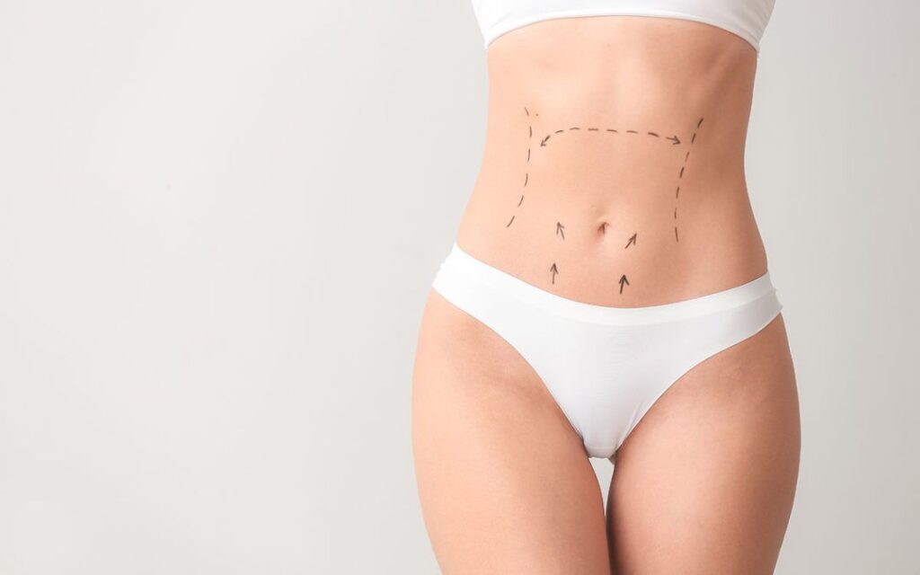 Tummy-Tuck-in-Toronto-1080x675